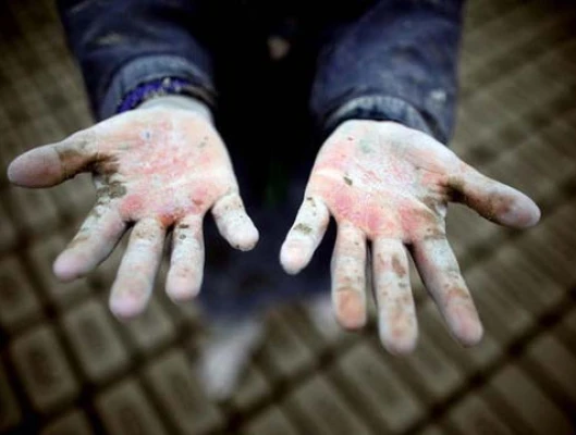 Να τερματίσουμε επιτέλους την παιδική εργασία